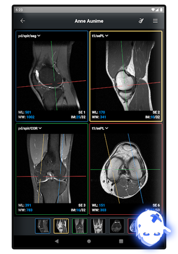 Няшкин Radiant DICOM Viewer (2113)